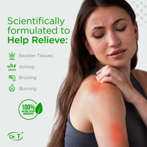 Spider Vein Cream to help relieve swollen tissues, itching, bruising, and burning